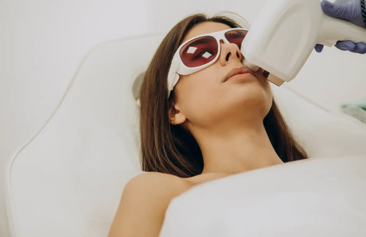 Bıyık Lazer Epilasyon