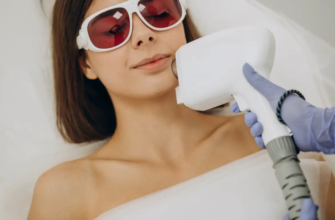 Çene Altı Lazer Epilasyon