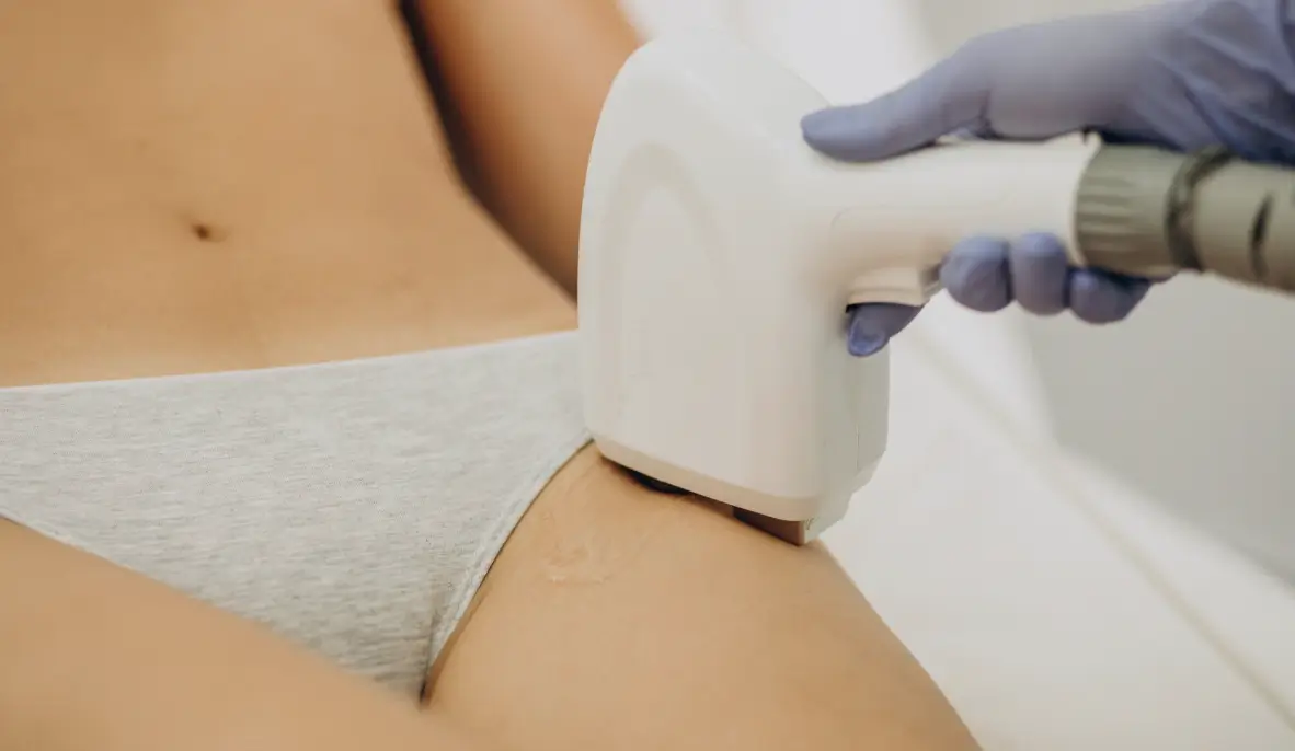 Bikini Bölgesine Lazer Epilasyon