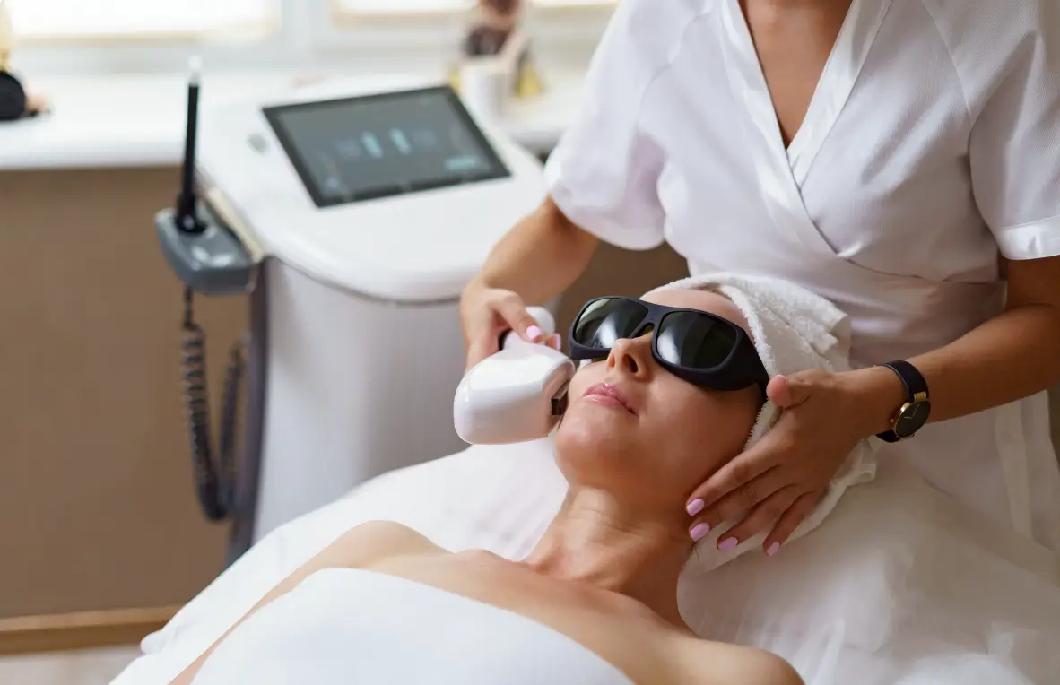 Yüz Bölgesine Lazer Epilasyon