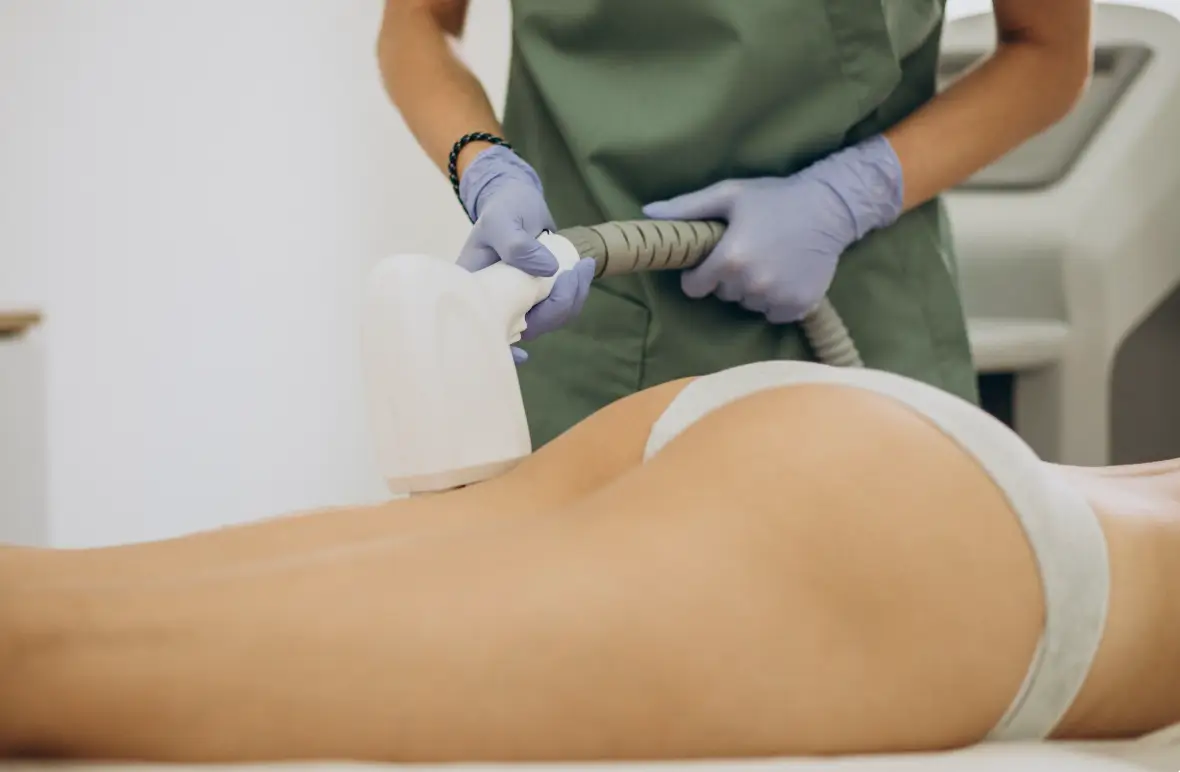 Popo Lazer Epilasyon Uygulaması