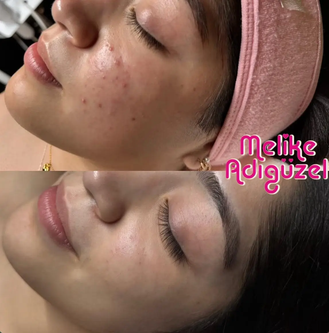 Genosys Kore Cilt Bakımı Hizmeti